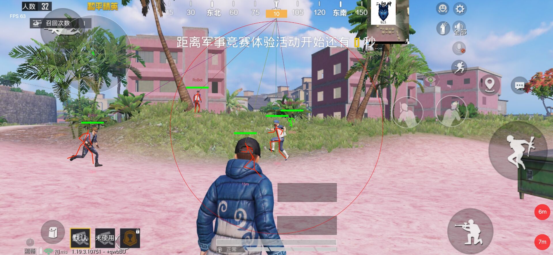 骨骼绘制示意图